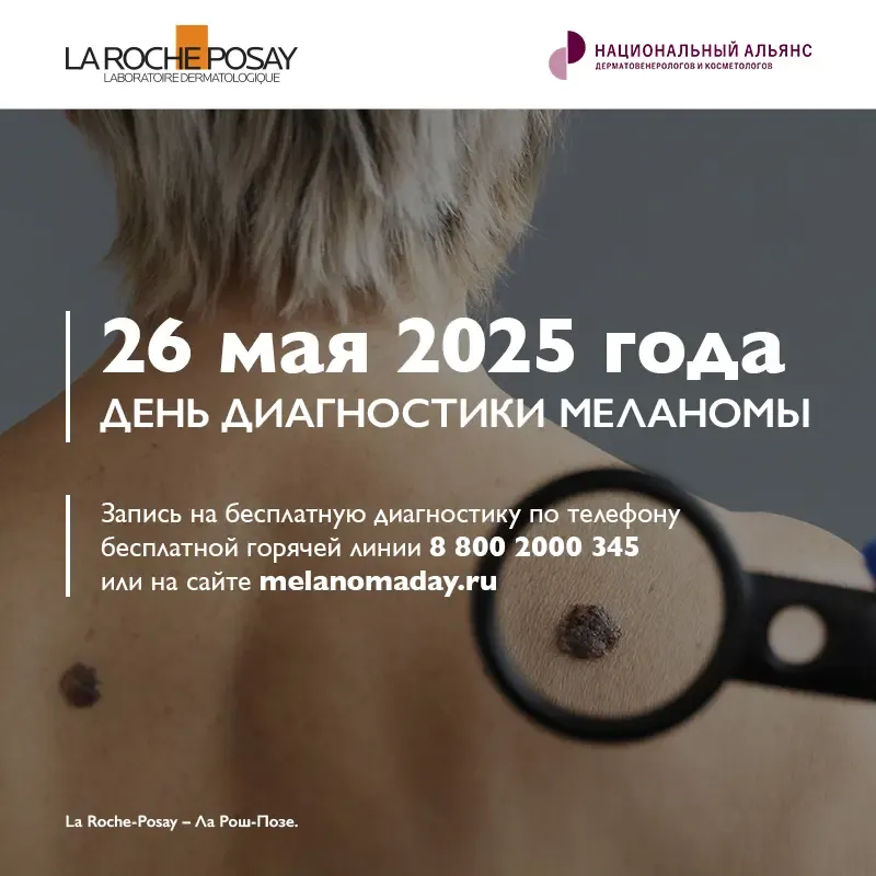 ДЕНЬ ДИАГНОСТИКИ МЕЛАНОМЫ